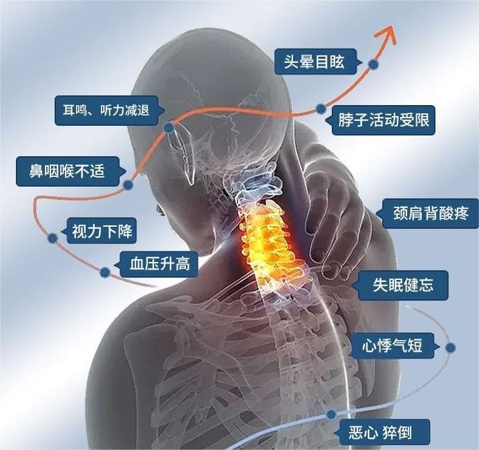非手術(shù)療法中哪種最有效 非手術(shù)療法中哪種最有效 龍魚百科 第7張
