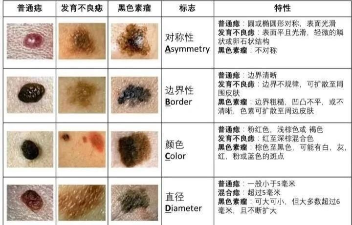 化學或激光干預去除色素的風險有多大（或激光干預去除色素的風險評估涉及多個因素涉及多個因素）