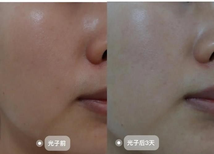 如何調(diào)整紅光與白光的比例（攝影中自動(dòng)白平衡和手動(dòng)白平衡的區(qū)別）