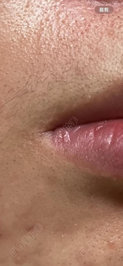 龍魚嘴角有白色肉芽圖片 龍魚嘴角有白色肉芽圖片 觀賞魚百科 第25張