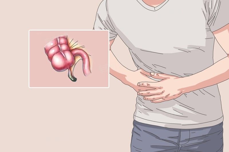 闌尾炎手術(shù)后如何預(yù)防復(fù)發(fā)