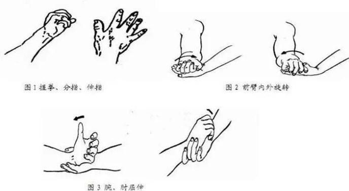 闌尾炎手術(shù)后如何預(yù)防復(fù)發(fā)