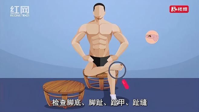 病理性黑鱗病早期治療成功率高嗎？