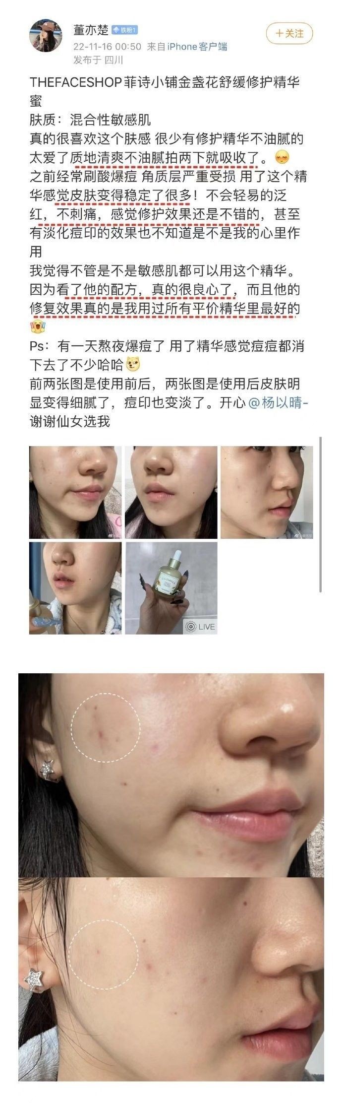 仟湖傲深系列哪個效果最好？（仟湖傲深系列哪個產品效果最好）