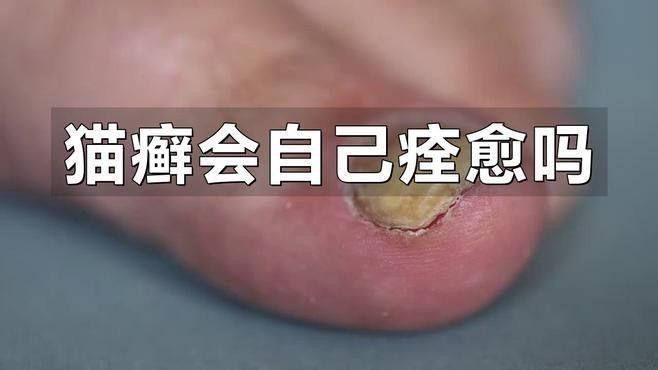 哪種治療方式對(duì)龍貓最安全