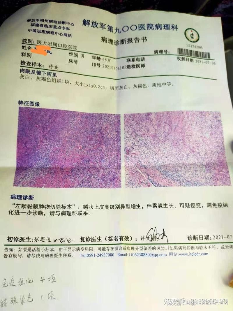 龍魚嘴起肉疙瘩圖解（魚嘴起肉疙瘩圖解）