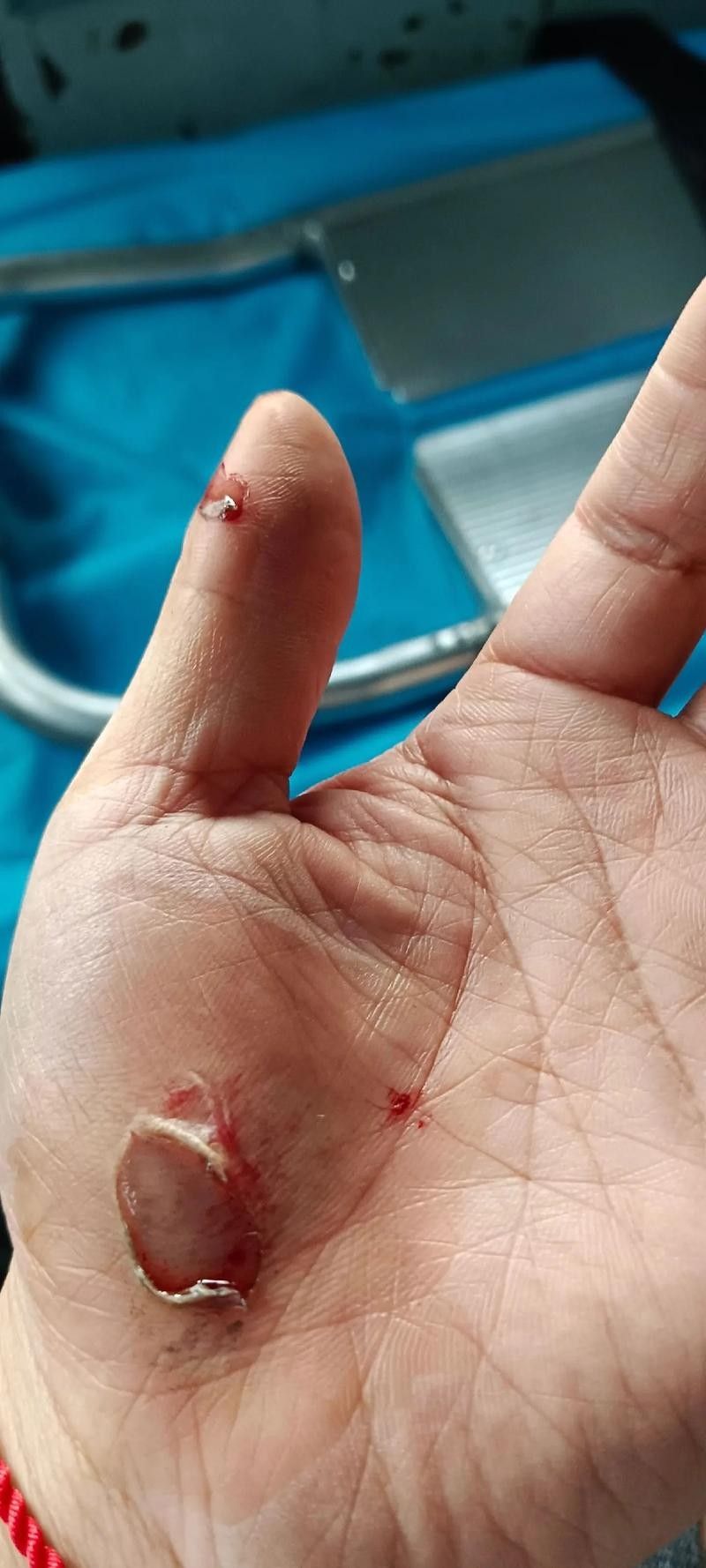如何促進(jìn)傷口愈合(傷口怎么樣愈合快) 龍魚百科 第5張 如何促進(jìn)傷口愈合(傷口怎么樣愈合快) 如何促進(jìn)傷口愈合(傷口怎么樣愈合快) 龍魚百科 第5張