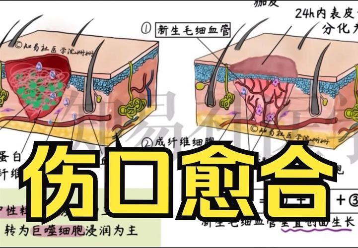 如何促進(jìn)傷口愈合(傷口怎么樣愈合快) 龍魚百科 第4張 如何促進(jìn)傷口愈合(傷口怎么樣愈合快) 如何促進(jìn)傷口愈合(傷口怎么樣愈合快) 龍魚百科 第4張