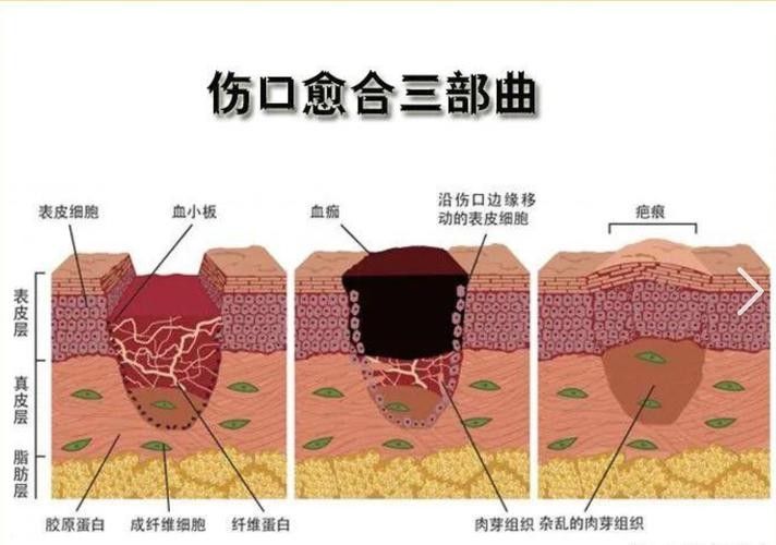 如何促進(jìn)傷口愈合(傷口怎么樣愈合快) 龍魚百科 第3張 如何促進(jìn)傷口愈合(傷口怎么樣愈合快) 如何促進(jìn)傷口愈合(傷口怎么樣愈合快) 龍魚百科 第3張