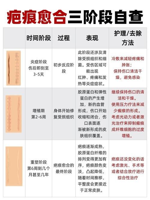 如何促進(jìn)傷口愈合(傷口怎么樣愈合快) 龍魚百科 第6張 如何促進(jìn)傷口愈合(傷口怎么樣愈合快) 如何促進(jìn)傷口愈合(傷口怎么樣愈合快) 龍魚百科 第6張