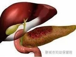 治療期間需要停食多久？（治療期間，通常建議患者暫停進食一段時間）