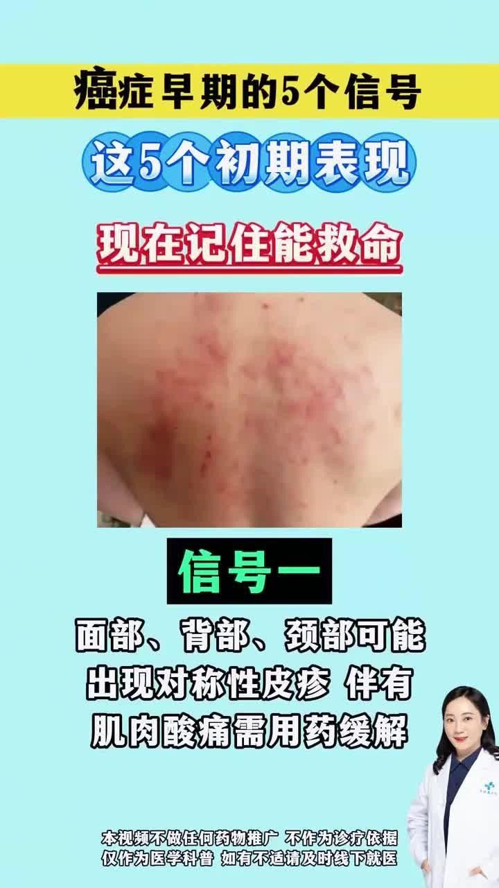 眼斑魚是癌癥早期癥狀（“眼斑魚”是癌癥早期癥狀，醫(yī)生提醒：眼睛出現(xiàn)4種變化）