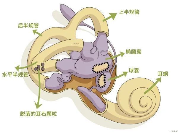 耳石復(fù)位法有哪些風險？（汨羅市人民醫(yī)院開展眩暈手法復(fù)位逃跑的“石頭”）