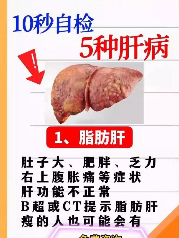 赤元素疾病（肝病來臨時(shí)，身體的6個(gè)信號(hào)，出現(xiàn)1個(gè)就要謹(jǐn)慎了）