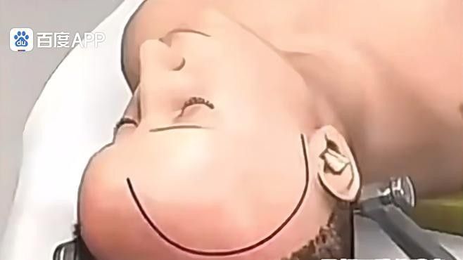 手術成功率高嗎？（|帶你了解開顱手術過程崔醫生講科普）