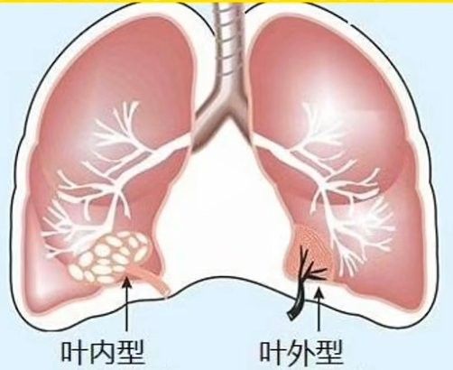 隔離期間需要喂食嗎（隔離期間是否需要喂食）