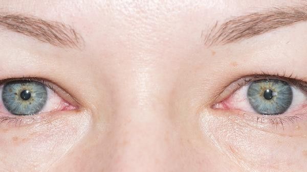 紅龍魚突眼病多久會(huì)好（紅龍魚突眼病的恢復(fù)時(shí)間）