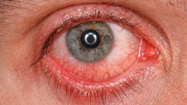 紅龍魚突眼病多久會(huì)好（紅龍魚突眼病的恢復(fù)時(shí)間）