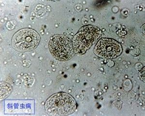 龍魚眼睛紅腫怎么治療圖片（關于龍魚眼睛紅腫的疑問） 龍魚眼睛紅腫怎么治療圖片（關于龍魚眼睛紅腫的疑問） 觀賞魚百科 第2張