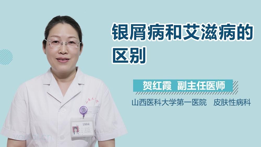 銀屑病和艾滋病的區(qū)別，銀屑病和艾滋病的區(qū)別是什么（銀屑病與艾滋病的區(qū)別）