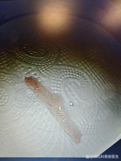 龍魚嘴的白色線狀物圖片