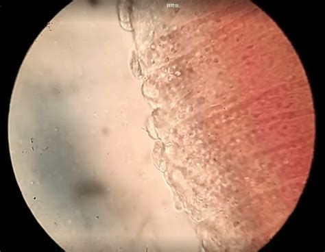 龍魚胸鰭抖動是怎么回事（龍魚胸鰭抖動可能是由多種寄生蟲感染引起的）