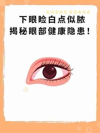 龍魚眼睛出現白點問題，預防龍魚眼睛白點的方法是什么（如何預防龍魚眼睛白點）