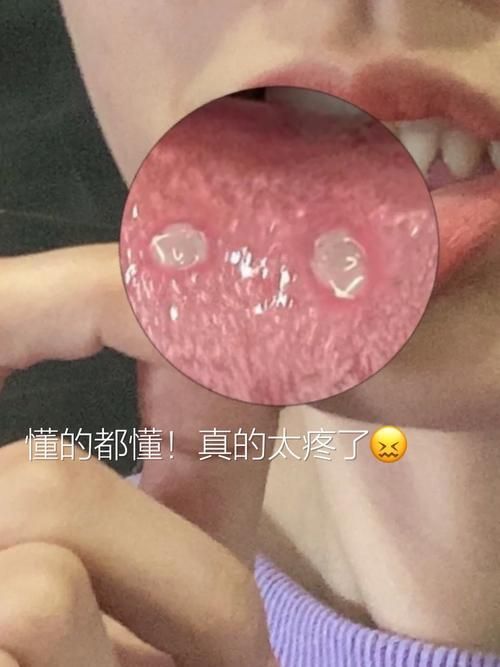 如何判斷龍魚嘴角長東西是否感染？（如何判斷觀賞魚（龍魚）健康診斷）