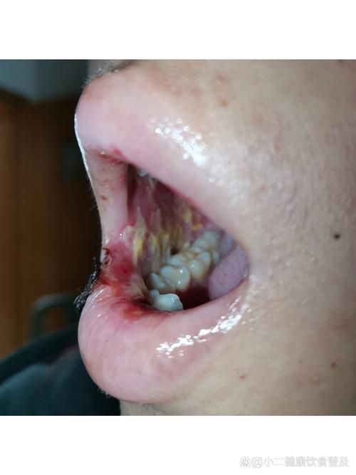 如何判斷龍魚嘴角長東西是否感染？（如何判斷觀賞魚（龍魚）健康診斷）