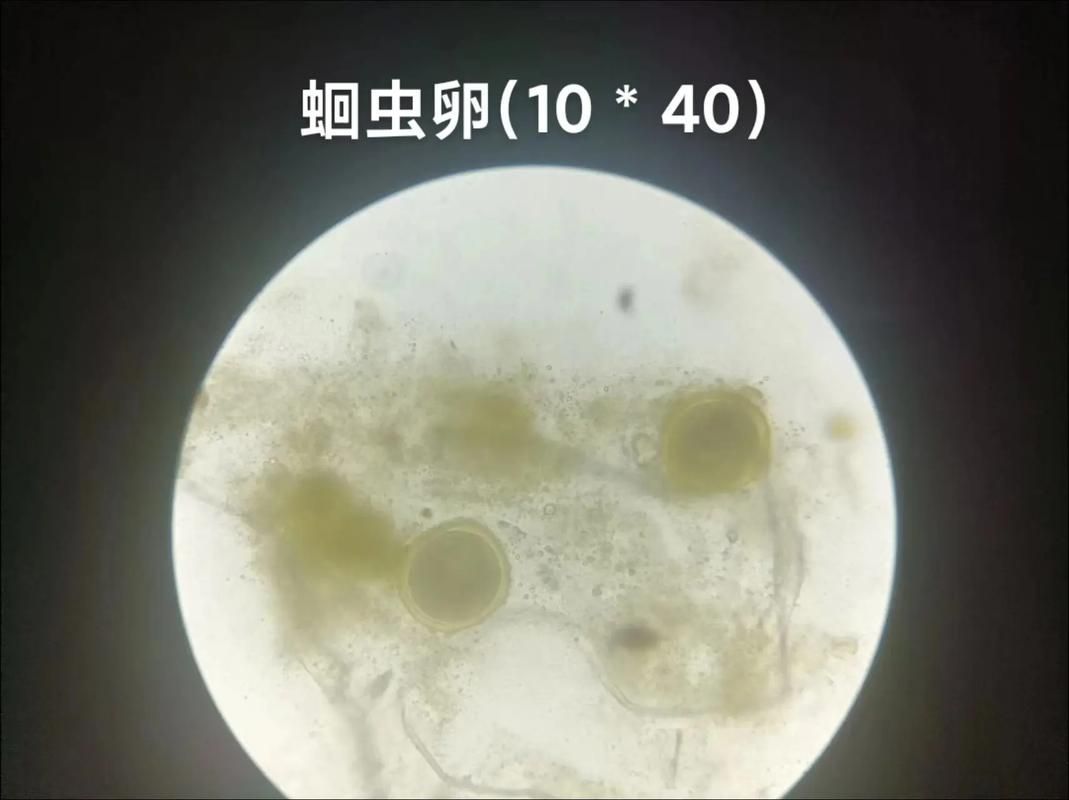 如何判斷龍魚腸炎是否由寄生蟲引起？（共調用3個工具判斷龍魚腸炎是否由寄生蟲引起）