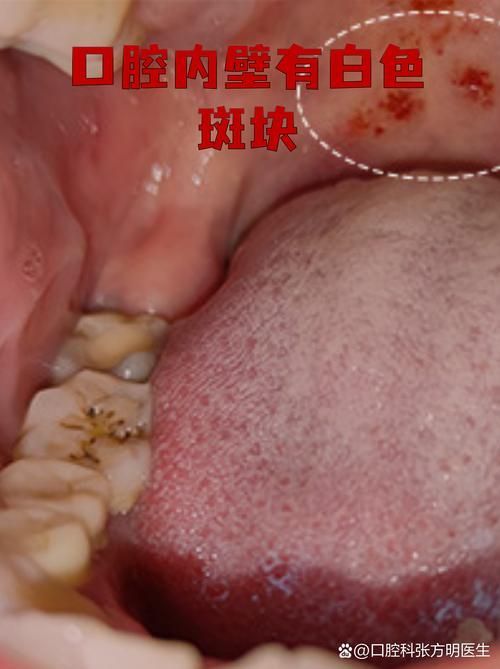 如何預防龍魚嘴上長肉球或癌？（mcp學術文章搜索服務（server_id=2）