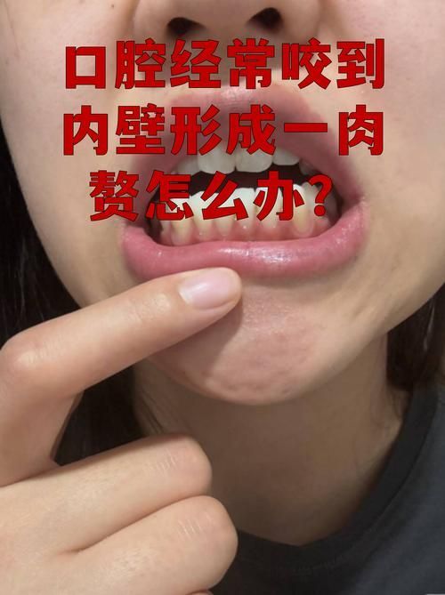 如何預防龍魚嘴上長肉球或癌？（mcp學術文章搜索服務（server_id=2）