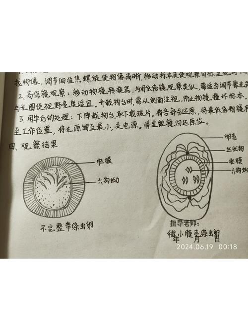 龍魚感染內寄后還能活多久？（arxiv論文助手（arxiv論文助手,龍魚感染內寄后能否存活）