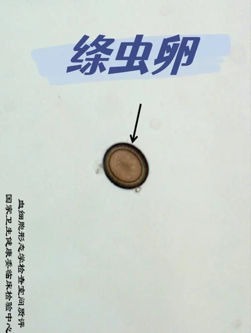 龍魚感染內寄后還能活多久？（arxiv論文助手（arxiv論文助手,龍魚感染內寄后能否存活）