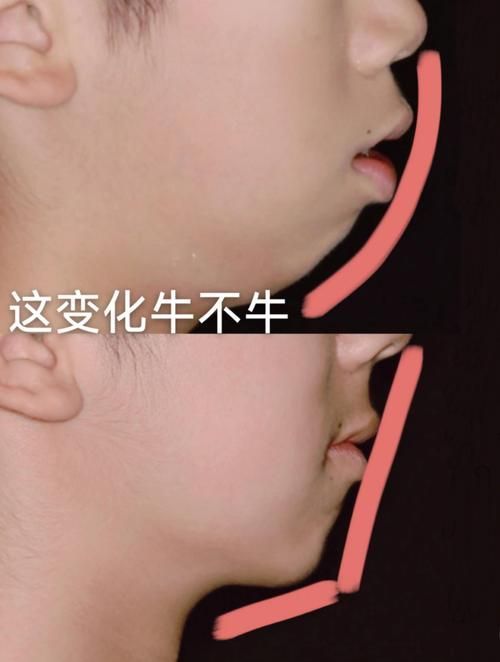 哪種方法矯正龍魚口合不攏最有效？（arxiv論文助手（arxiv論文助手）哪種方法矯正最有效）
