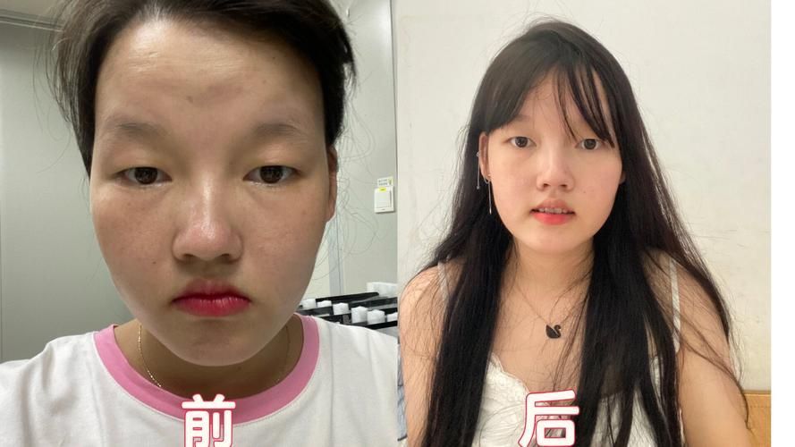 哪種方法矯正龍魚口合不攏最有效？（arxiv論文助手（arxiv論文助手）哪種方法矯正最有效）