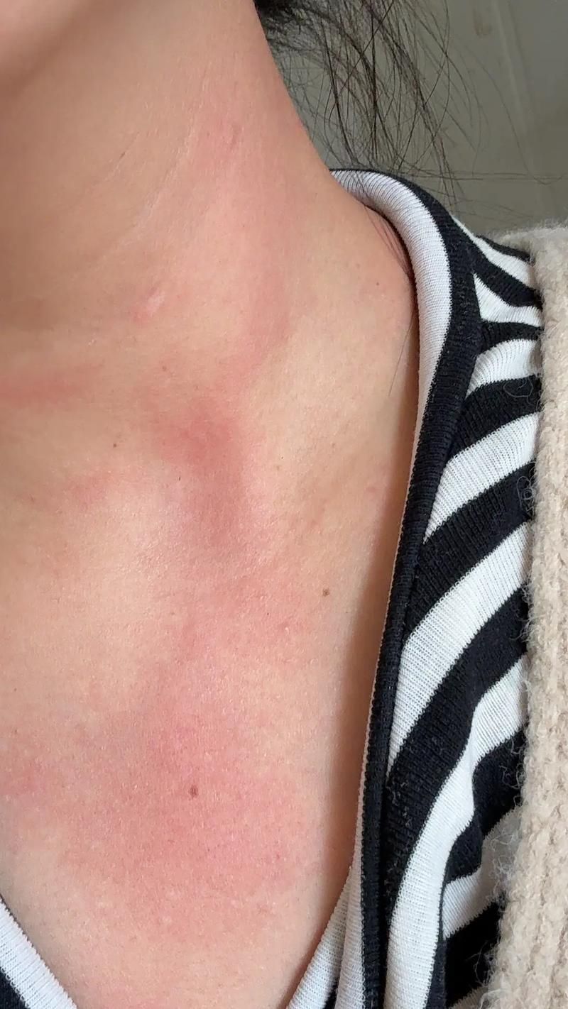 如何判斷自己是否對鱘龍魚過敏?(———醫(yī)學診斷鱘龍魚過敏診斷流程詳解) 龍魚百科 第5張 如何判斷自己是否對鱘龍魚過敏?(———醫(yī)學診斷鱘龍魚過敏診斷流程詳解) 如何判斷自己是否對鱘龍魚過敏?(———醫(yī)學診斷鱘龍魚過敏診斷流程詳解) 龍魚百科 第5張