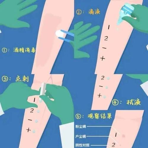 如何判斷自己是否對鱘龍魚過敏?(———醫(yī)學診斷鱘龍魚過敏診斷流程詳解) 龍魚百科 第9張 如何判斷自己是否對鱘龍魚過敏?(———醫(yī)學診斷鱘龍魚過敏診斷流程詳解) 如何判斷自己是否對鱘龍魚過敏?(———醫(yī)學診斷鱘龍魚過敏診斷流程詳解) 龍魚百科 第9張