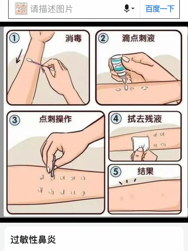 如何判斷自己是否對鱘龍魚過敏?(———醫(yī)學診斷鱘龍魚過敏診斷流程詳解) 龍魚百科 第7張 如何判斷自己是否對鱘龍魚過敏?(———醫(yī)學診斷鱘龍魚過敏診斷流程詳解) 如何判斷自己是否對鱘龍魚過敏?(———醫(yī)學診斷鱘龍魚過敏診斷流程詳解) 龍魚百科 第7張