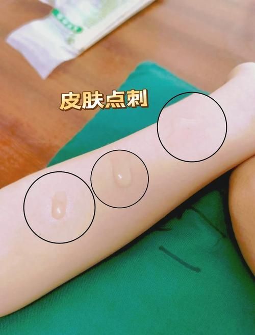 如何判斷自己是否對鱘龍魚過敏?(———醫(yī)學診斷鱘龍魚過敏診斷流程詳解) 龍魚百科 第11張 如何判斷自己是否對鱘龍魚過敏?(———醫(yī)學診斷鱘龍魚過敏診斷流程詳解) 如何判斷自己是否對鱘龍魚過敏?(———醫(yī)學診斷鱘龍魚過敏診斷流程詳解) 龍魚百科 第11張