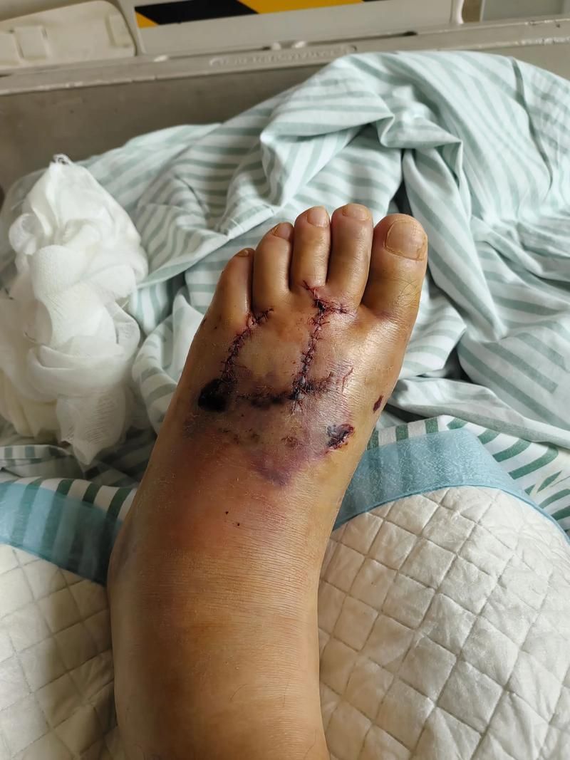 金龍魚翻鰓手術后護理要點（金龍魚翻鰓手術后護理）