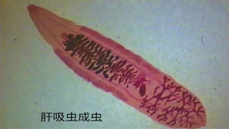 哪些常見的魚寄生蟲對人體有害（中國衛健委與國家食品安全風險評估中心魚寄生蟲詳解）