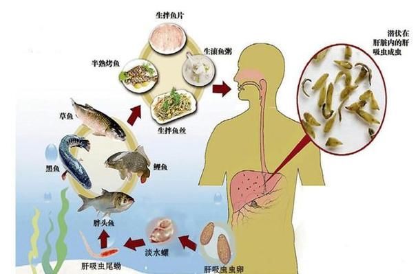 哪些常見的魚寄生蟲對人體有害（中國衛健委與國家食品安全風險評估中心魚寄生蟲詳解）