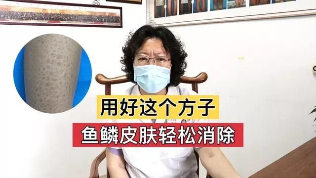 有哪些方法可以去除小腿魚鱗紋（去除小腿魚鱗紋的方法多種多樣）