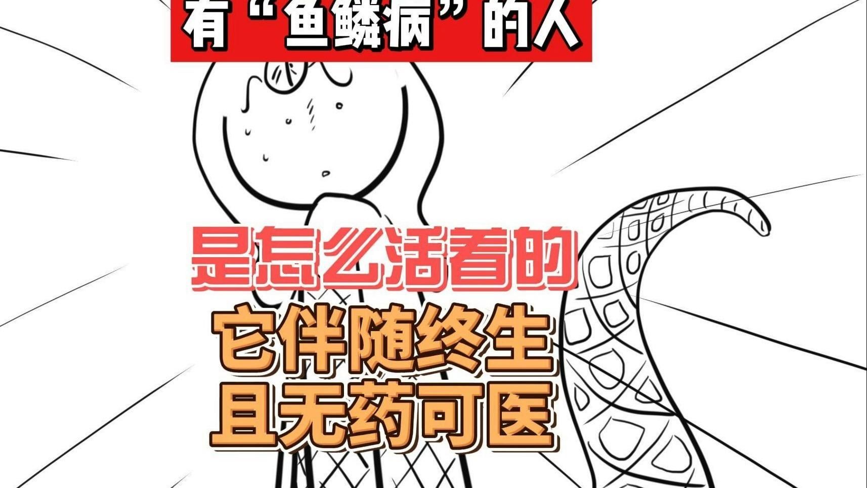 魚鱗病能自愈嗎（什么是魚鱗病該怎么處理）