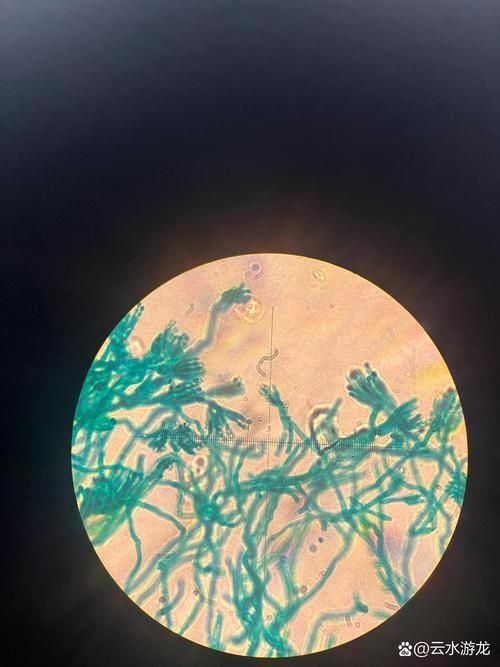 能否提供農(nóng)作物真菌和細(xì)菌的顯微鏡下圖像（關(guān)于農(nóng)作物真菌和細(xì)菌的顯微鏡下圖像的摘要）