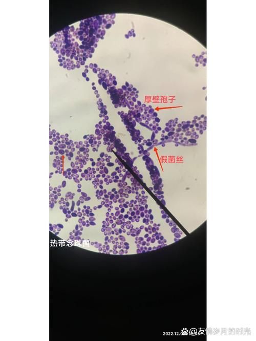 能否提供農(nóng)作物真菌和細(xì)菌的顯微鏡下圖像（關(guān)于農(nóng)作物真菌和細(xì)菌的顯微鏡下圖像的摘要）