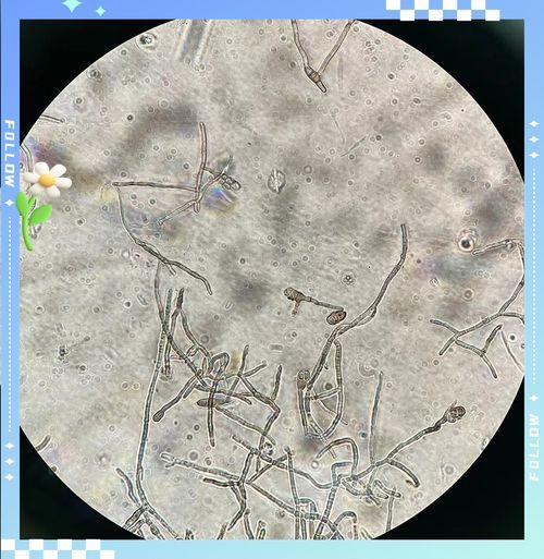 能否提供農(nóng)作物真菌和細(xì)菌的顯微鏡下圖像（關(guān)于農(nóng)作物真菌和細(xì)菌的顯微鏡下圖像的摘要）