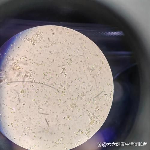 能否提供農(nóng)作物真菌和細(xì)菌的顯微鏡下圖像（關(guān)于農(nóng)作物真菌和細(xì)菌的顯微鏡下圖像的摘要）
