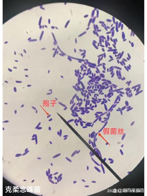 能否提供農(nóng)作物真菌和細(xì)菌的顯微鏡下圖像（關(guān)于農(nóng)作物真菌和細(xì)菌的顯微鏡下圖像的摘要）
